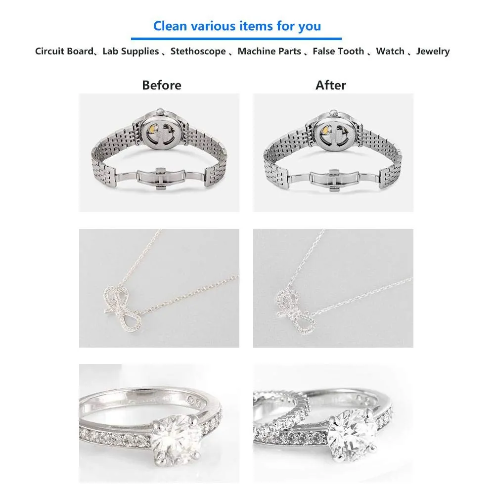 Sterilizator Ultrasonic Profesional 120T, 2L, 60W - Image 4